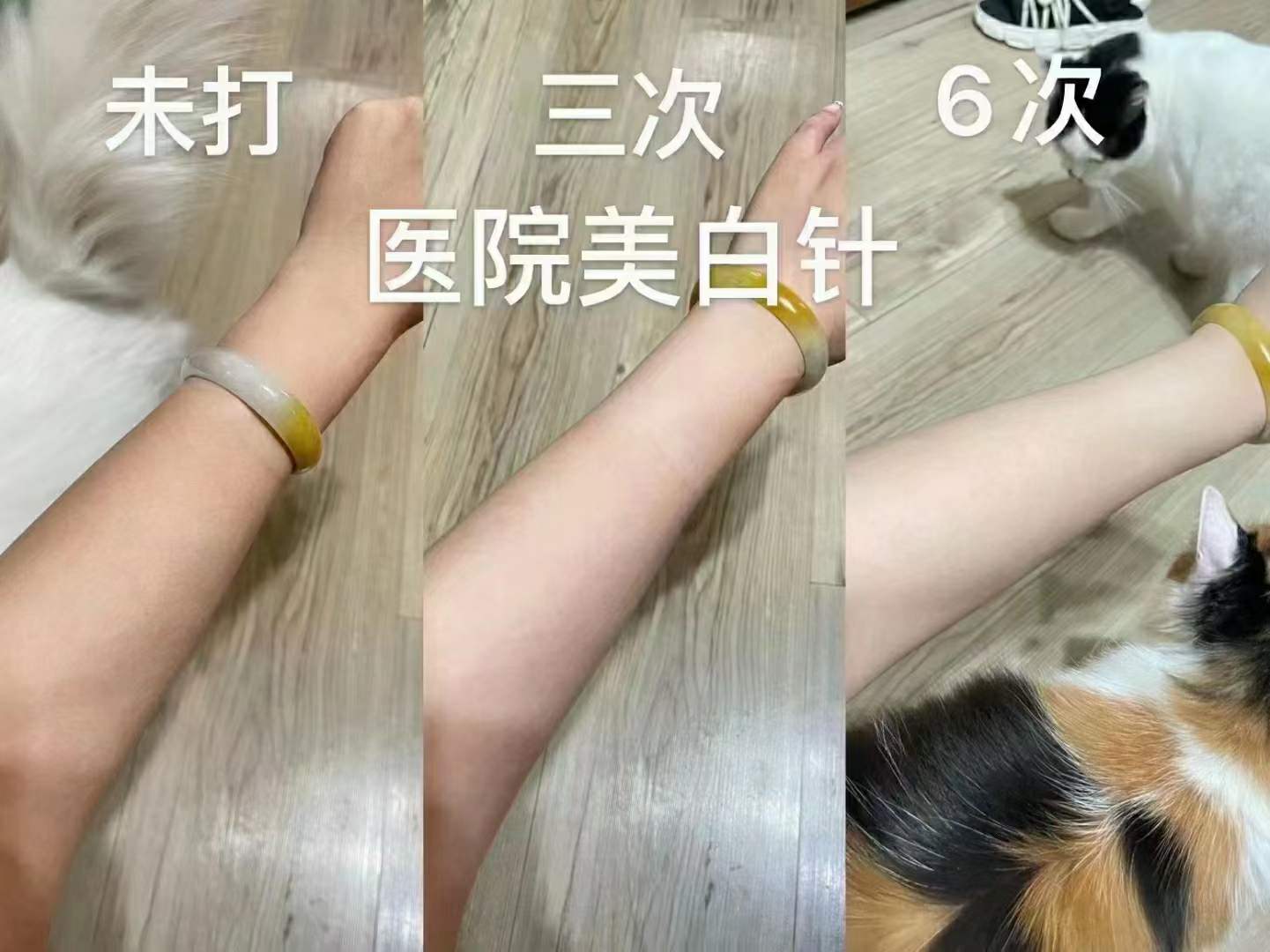 铂金美白针