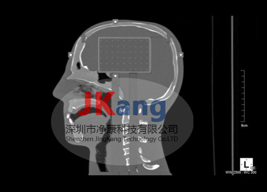 CIRS 038立体定向模体