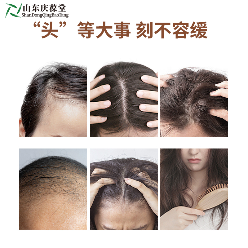 植物洗发水批发 防脱发洗发水代加工厂家